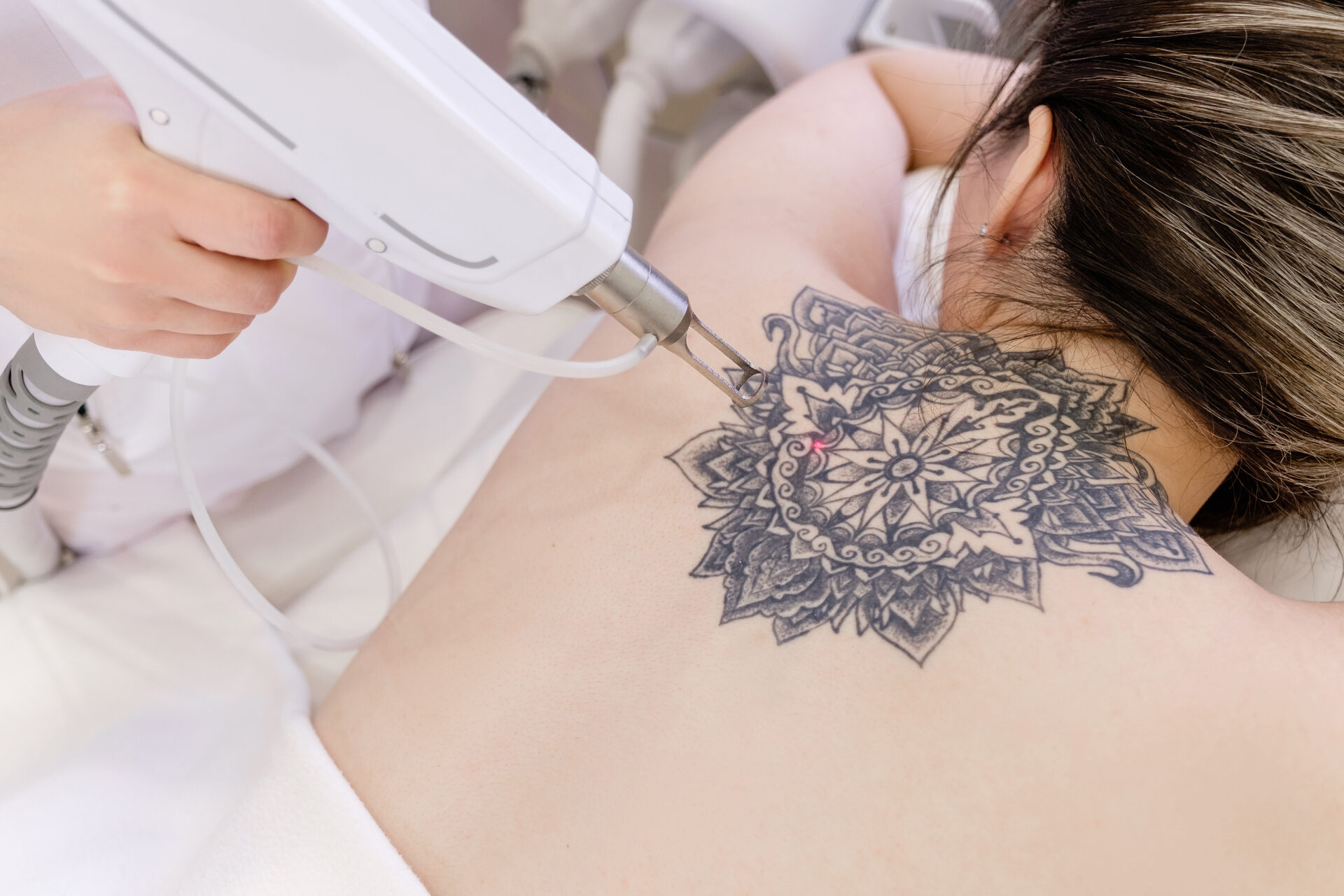 Tatuaż można usunąć w ramach NHS. Foto: shutterstock.com
