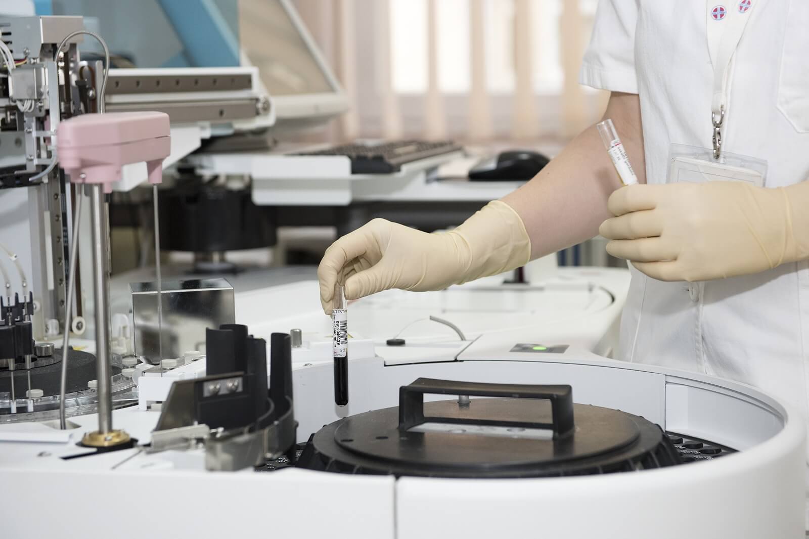 Leczenie białaczki czeka przełom. Pacjenci nie będą musieli przechodzić chemioterapii? (fot: Pxhere/CCO domena publiczna)