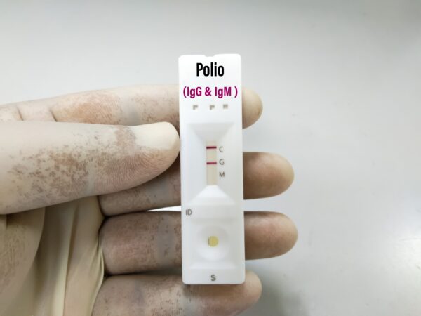 Wirus Polio wykryty w Londynie. Czy istnieje zagrożenie dla zdrowia?