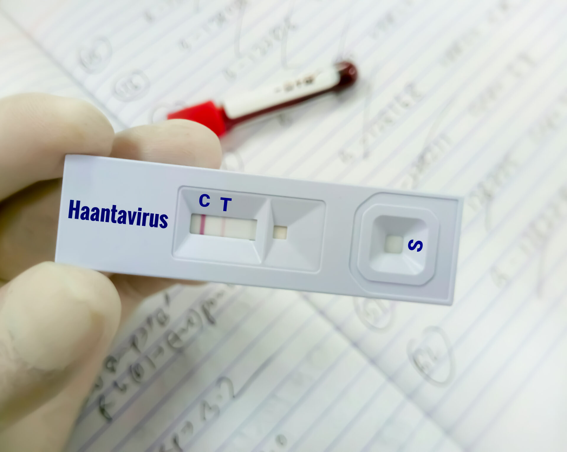 Hantawirus Andes wykryty na statku. Brytyjczycy wrócili do UK. Foto: shutterstock.com